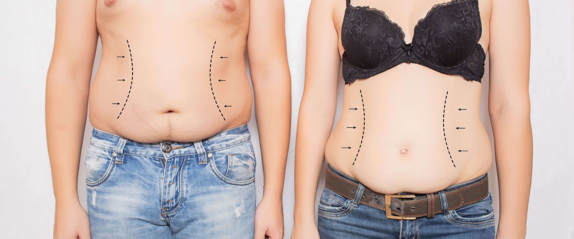 Understanding Asymmetry in Body Contouring