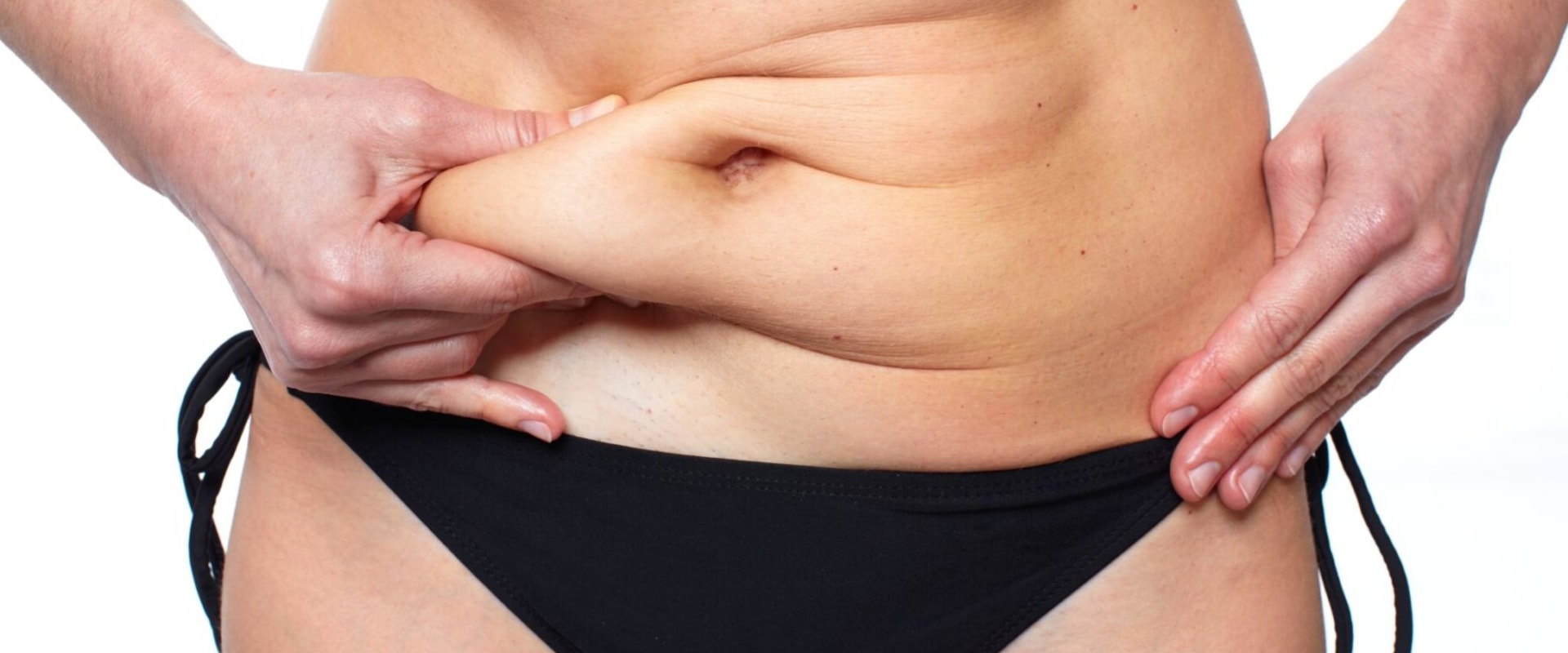 A Complete Guide to Tummy Tuck Procedures