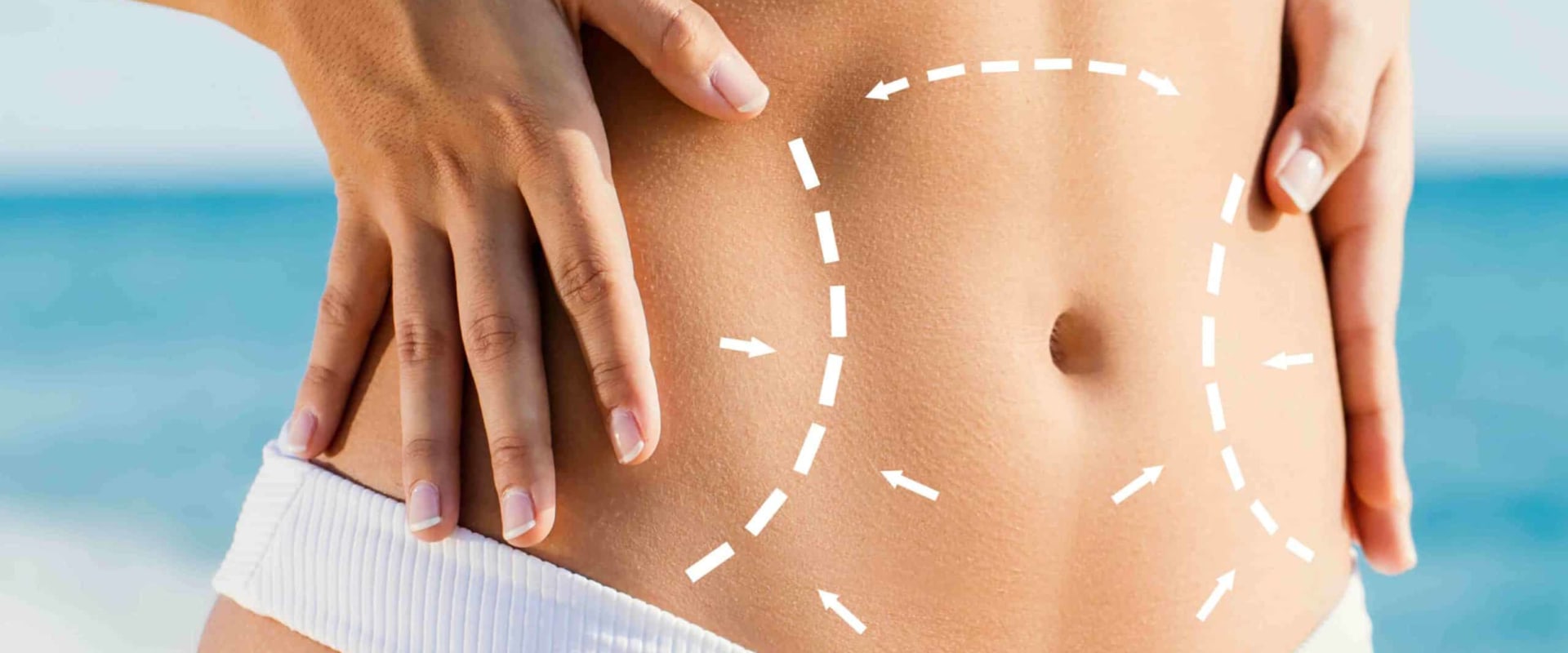 All About Lipo-abdominoplasty: A Comprehensive Guide to Body Contouring Techniques