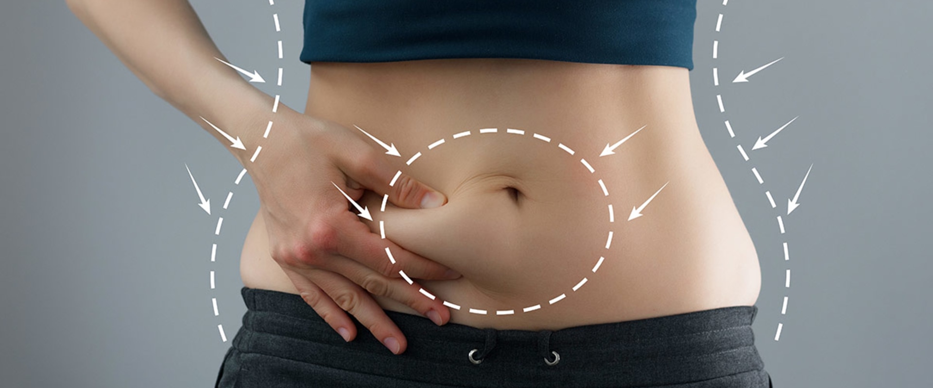 The Basics of Tummy Tucks: Achieving Your Desired Body Shape