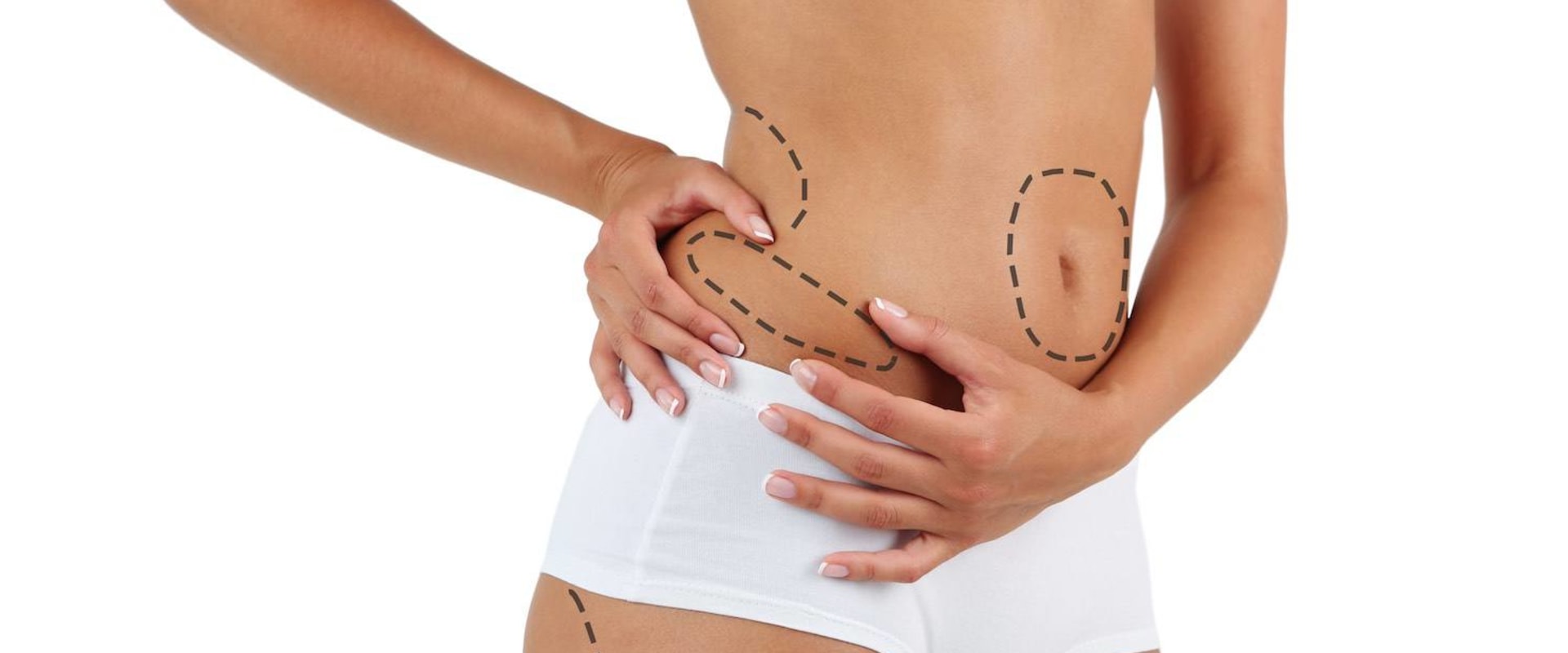 All You Need to Know About Liposuction