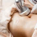 Microneedling: The Minimally Invasive Technique for Body Contouring