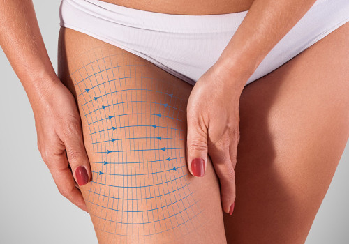 Thigh Lift: Enhancing Your Appearance with Surgical Body Contouring