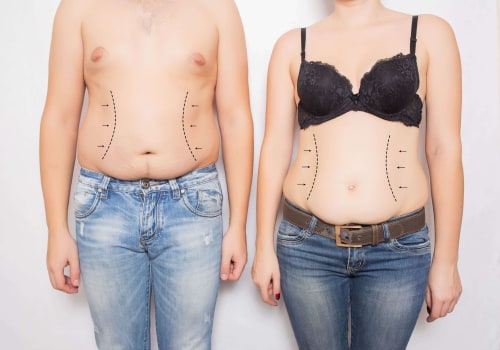 Understanding Asymmetry in Body Contouring