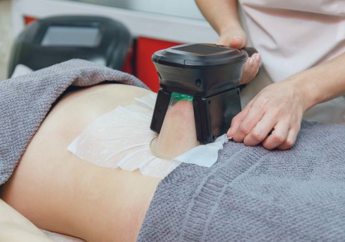 Exploring Cryolipolysis for Non-Invasive Body Contouring