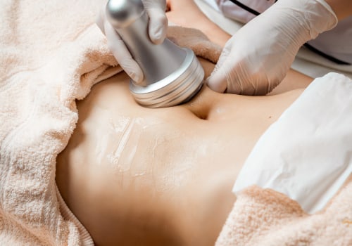 Microneedling: The Minimally Invasive Technique for Body Contouring