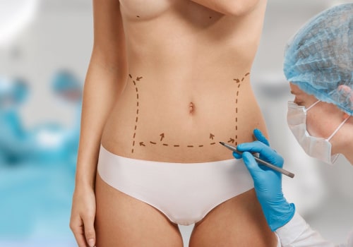 Pre-surgery Instructions for Body Contouring Procedures