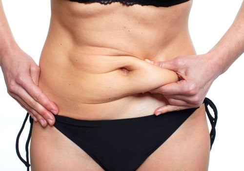 A Complete Guide to Tummy Tuck Procedures