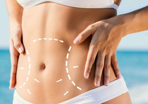 All About Lipo-abdominoplasty: A Comprehensive Guide to Body Contouring Techniques